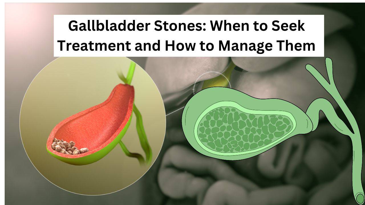 Gallbladder Stones